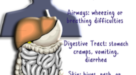 Timeline: Immune System Response to a Food Based Reaction