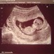 Baby 12 weeks
