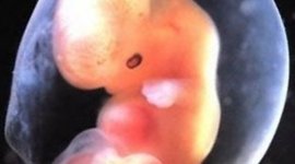 Timeline: Prenatal Development