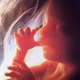 Fetal development