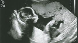 Timeline: My Pregnancy