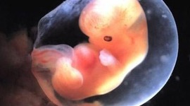 Timeline: Week 6 Pregnancy