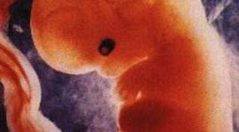 Timeline: Fetal Development Timeline