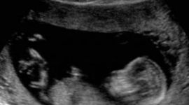 Timeline: Fetal Development