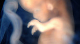 Timeline: Developmental Timeline