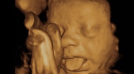 Timeline: History Of OB/GYN  Ultrasound