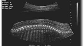 Timeline: History of Ultrasound