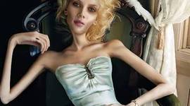 Timeline: HISTORIA DE LA ANOREXIA