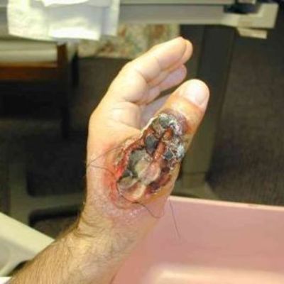 Timeline: joe smith 8Q2