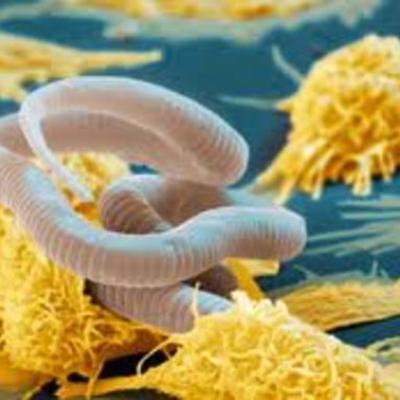 Timeline: The Discovery of the Various Stages of Elephantasis