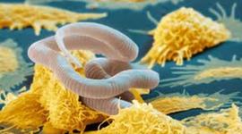 Timeline: The Discovery of the Various Stages of Elephantasis