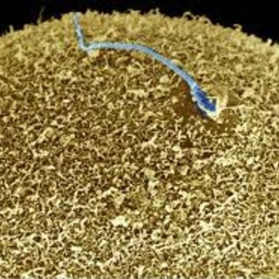 Timeline: Beyond fertilisation