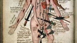 Timeline: ANOMALIAS MEDICAS