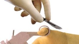 Timeline: evolución historica de la instrumentación quirúgica