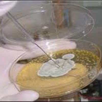 Timeline: historia y evolucion de la bacteriologia