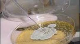 Timeline: historia y evolucion de la bacteriologia