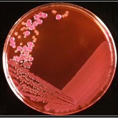 Timeline: bacteriologia