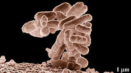 Timeline: Historical Perspectives Microbiology