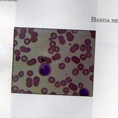 Timeline: HISTORIA DE LA BACTERIOLOGIA