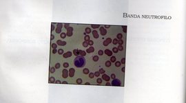 Timeline: HISTORIA DE LA BACTERIOLOGIA