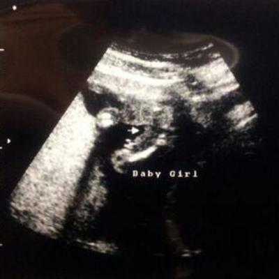 Timeline: Leah Wagner's Prenatal Development Timeline