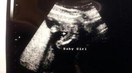 Timeline: Leah Wagner's Prenatal Development Timeline