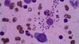 Timeline: HISTORIA DE LA MEDICINA UAN 1