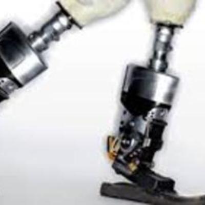 Timeline: Prothetics