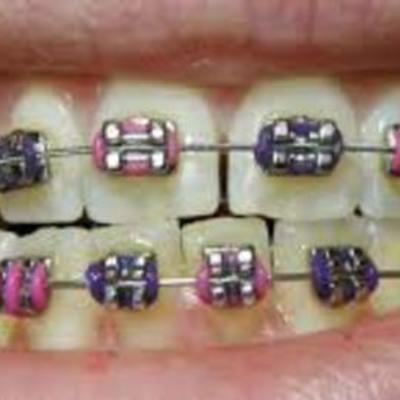 Timeline: Kistler, Michael- Timeline