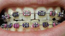 Timeline: Kistler, Michael- Timeline