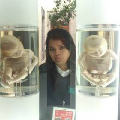 Timeline: DESARROLLO EMBRIONAL Y FETAL