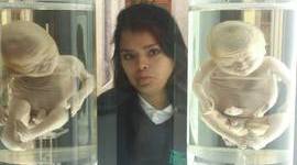 Timeline: DESARROLLO EMBRIONAL Y FETAL