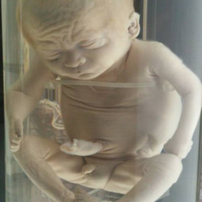 Timeline: ETAPAS DEL DESARROLLO EMBRIONARIO Y FETAL