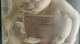 Timeline: ETAPAS DEL DESARROLLO EMBRIONARIO Y FETAL