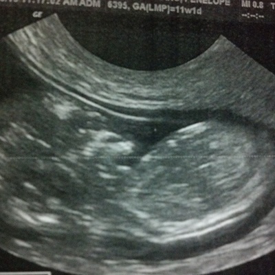 Timeline: 16 semanas de embarazo