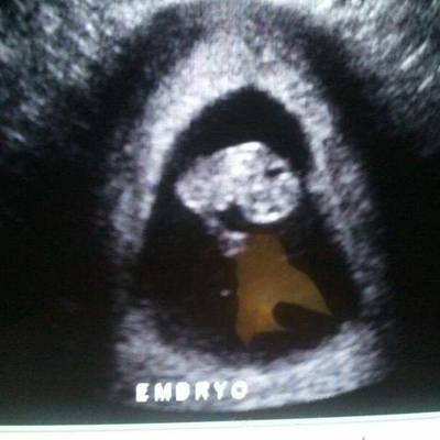 Timeline: 8 semanas de embarazo