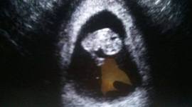 Timeline: 8 semanas de embarazo