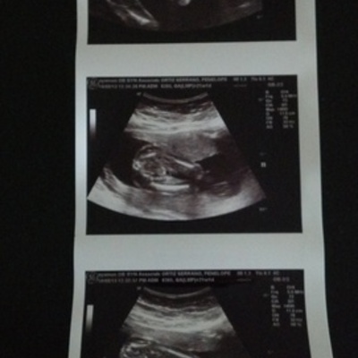 Timeline: Cronologia del Embarazo de Penelope