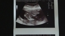 Timeline: Cronologia del Embarazo de Penelope