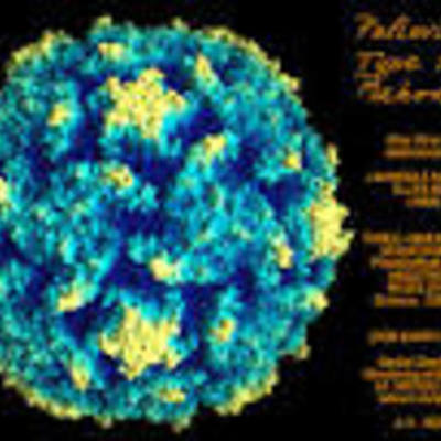 Timeline: Poliomyelitis