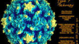 Timeline: Poliomyelitis