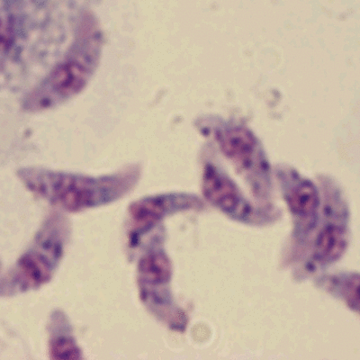 Timeline: Toxoplasmosis
