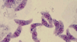 Timeline: Toxoplasmosis