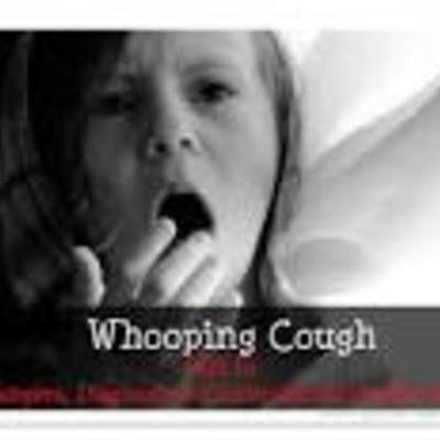 Timeline: Pertussis ( Whooping Cough)
