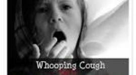 Timeline: Pertussis ( Whooping Cough)