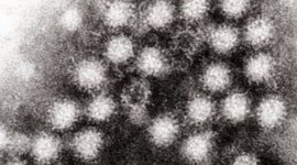 Timeline: History Of The Stomach Flu