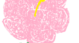 Timeline: Noelani Kekuia Immigration Timeline