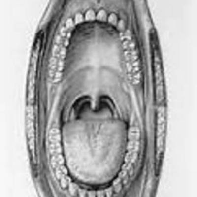 Timeline: Oral Thrush