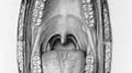 Timeline: Oral Thrush