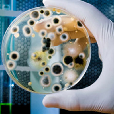 Timeline: History of Bacterial Control